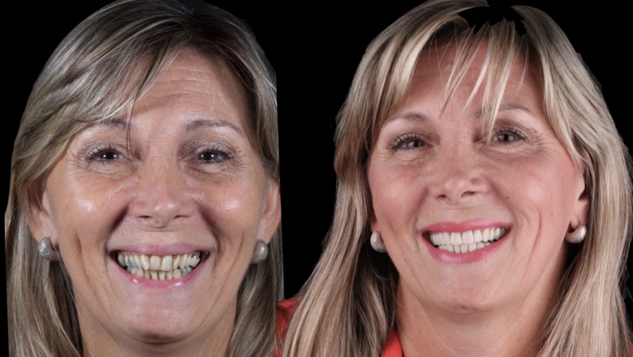 Dr. Ariel Merino - smile dental