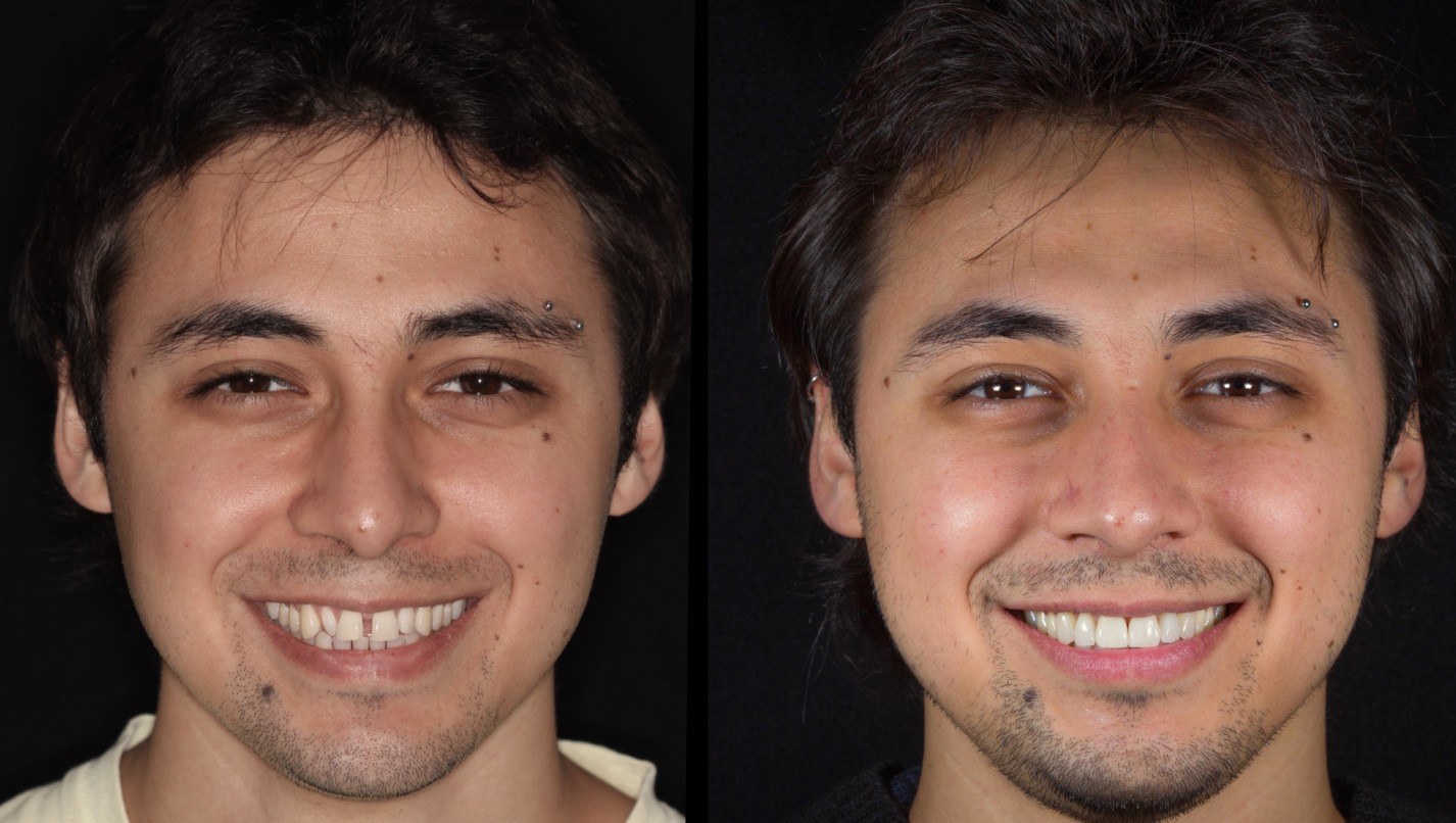 Dr. Ariel Merino - smile
